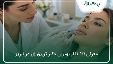 بهترین دکتر تزریق ژل در تبریز