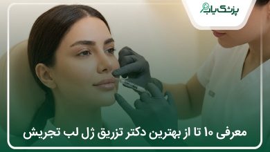 بهترین دکتر تزریق ژل لب تجریش