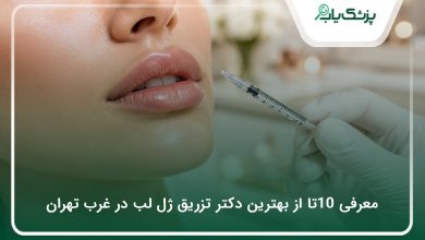 بهترین دکتر تزریق ژل لب در غرب تهران