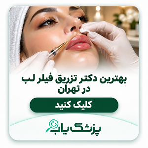 بهترین دکتر تزریق فیلر لب در تهران
