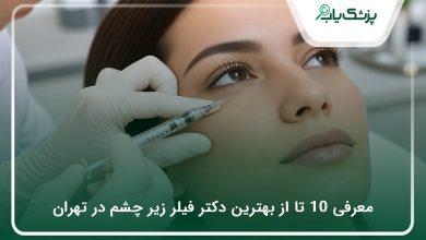 بهترین دکتر فیلر زیر چشم در تهران