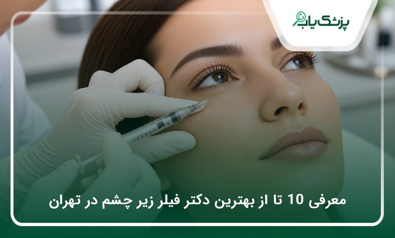 بهترین دکتر فیلر زیر چشم در تهران