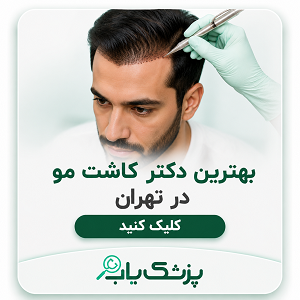 بهترین دکتر کاشت مو در تهران