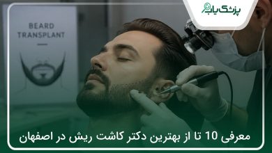 بهترین دکتر کاشت ریش در اصفهان