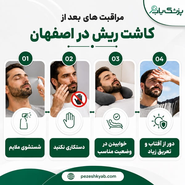 مراقبت های بعد از کاشت ریش در اصفهان