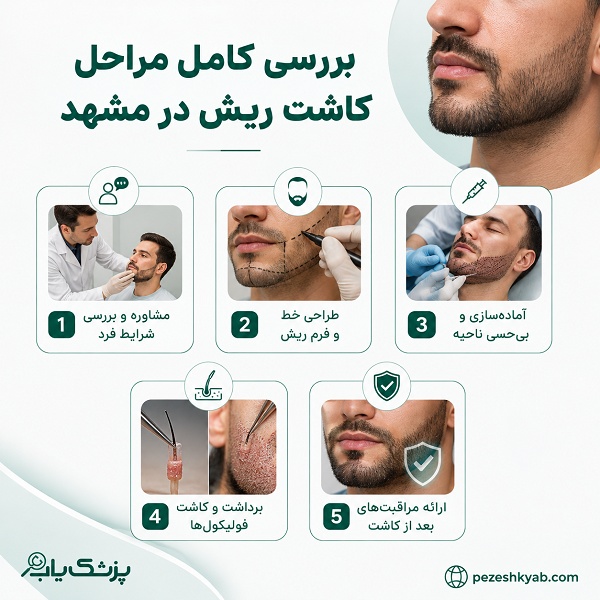 بررسی کامل مراحل کاشت ریش در مشهد