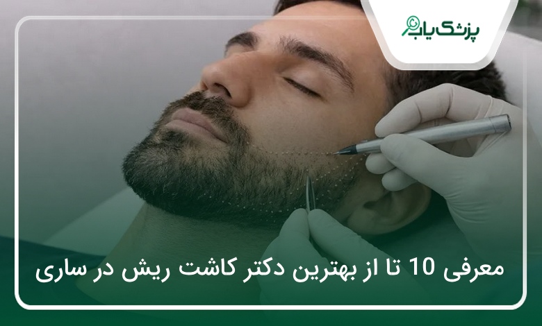 بهترین دکتر کاشت ریش در ساری