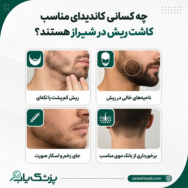 چه کسانی کاندیدای مناسب کاشت ریش در شیراز هستند؟