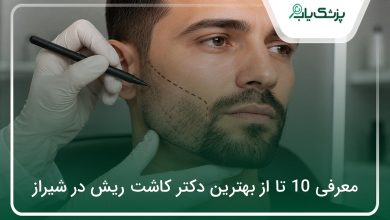 بهترین دکتر کاشت ریش در شیراز