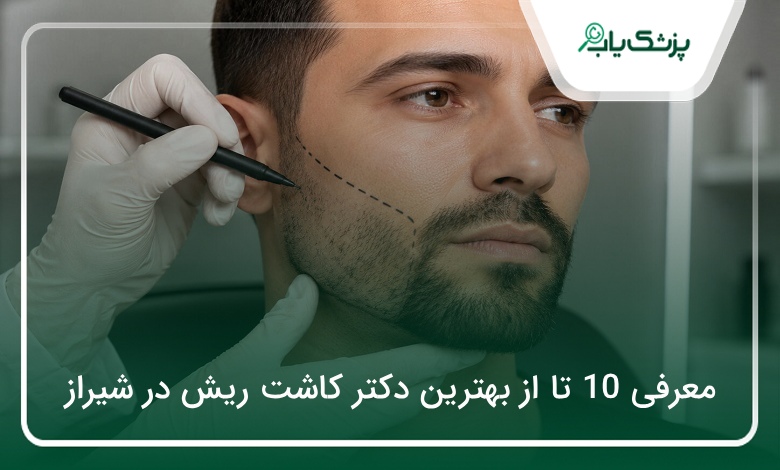بهترین دکتر کاشت ریش در شیراز