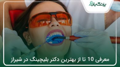 بهترین دکتر بلیچینگ در شیراز