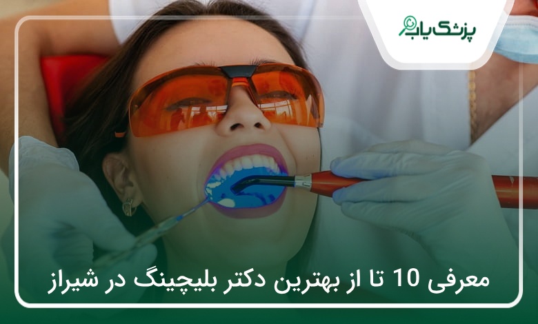 بهترین دکتر بلیچینگ در شیراز