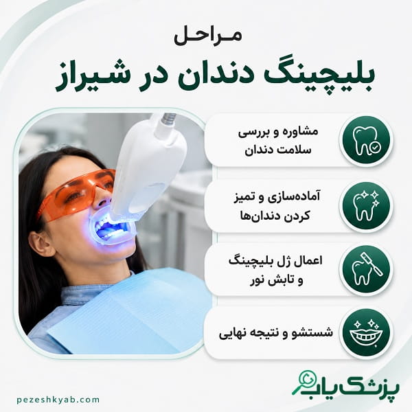 مراحل بلیچنگ دندان در شیراز
