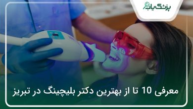 بهترین دکتر بلیچینگ در تبریز