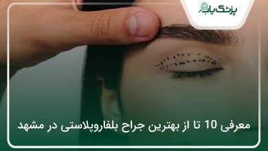 بهترین جراح بلفاروپلاستی در مشهد