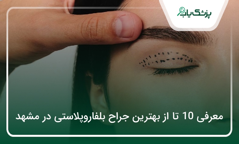 بهترین جراح بلفاروپلاستی در مشهد