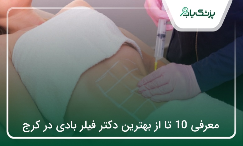 بهترین دکتر فیلر بادی در کرج