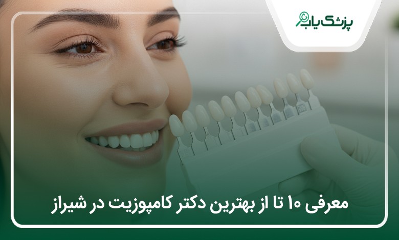 بهترین دکتر کامپوزیت در شیراز