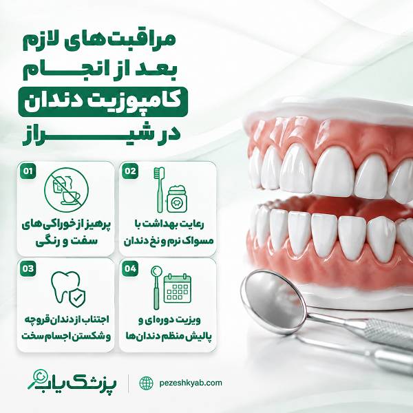 مراقبتهای لازم بعد از انجام کامپوزیت دندان در شیراز