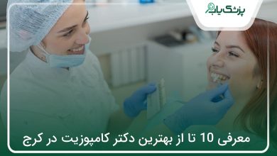 بهترین دکتر کامپوزیت در کرج