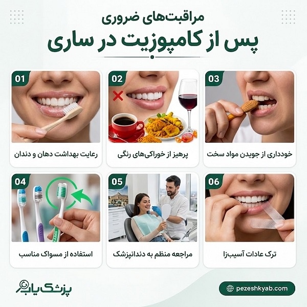 مراقبت های ضروری پس از انجام کامپوزیت در ساری