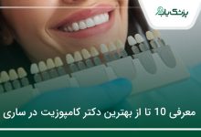 بهترین دکتر کامپوزیت در ساری