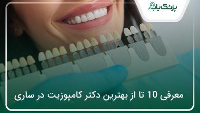 بهترین دکتر کامپوزیت در ساری