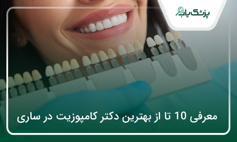 بهترین دکتر کامپوزیت در ساری