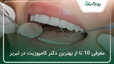 بهترین دکتر کامپوزیت در تبریز