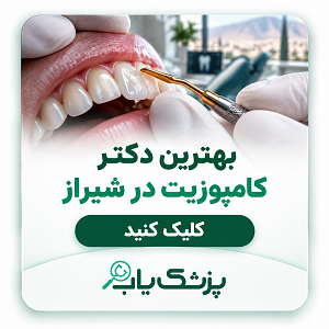 بهترین دکتر کامپوزیت در شیراز