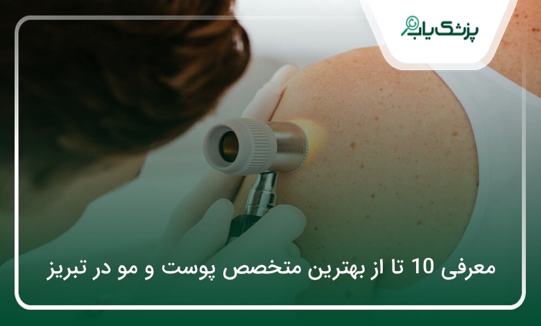 بهترین متخصص پوست و مو در تبریز
