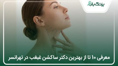 بهترین دکتر ساکشن غبغب در تهرانسر