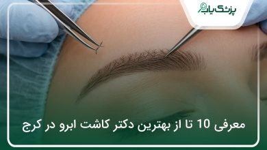 بهترین دکتر کاشت ابرو در کرج