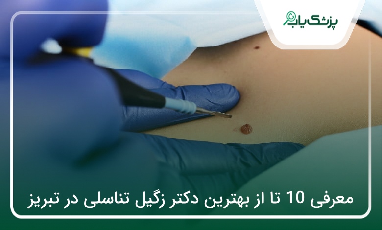 بهترین دکتر زگیل تناسلی در تبریز