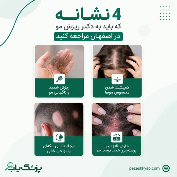 4 نشانه که باید به دکتر ریزش مو در اصفهان مراجعه کنید
