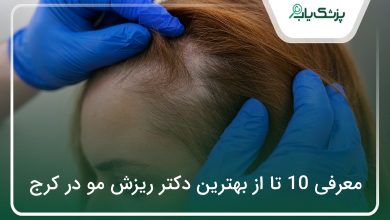 بهترین دکتر ریزش مو در کرج