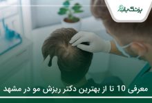 بهترین دکتر ریزش مو در مشهد