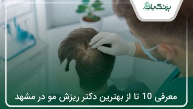 بهترین دکتر ریزش مو در مشهد