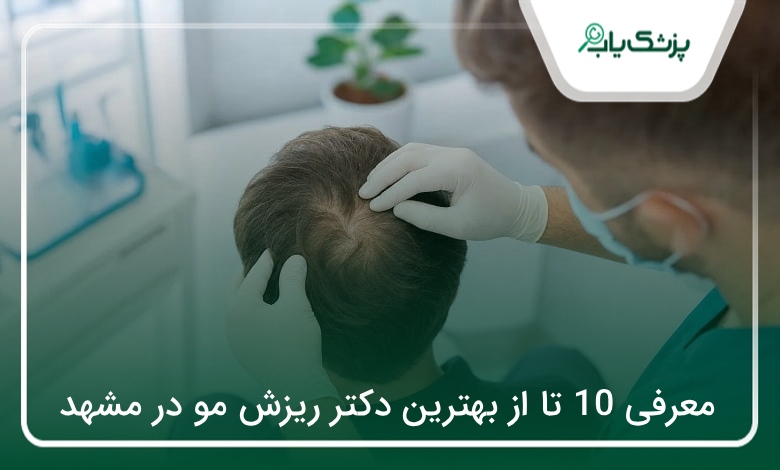 بهترین دکتر ریزش مو در مشهد