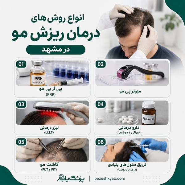 انواع روش های درمان ریزش مو در مشهد