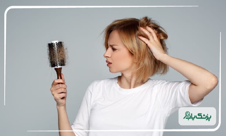 علل ریزش مو در زنان و مردان چیست؟