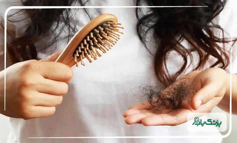 درمان ریزش مو توسط بهترین متخصصان در ساری