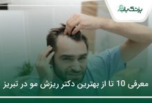 بهترین دکتر ریزش مو در تبریز