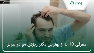 بهترین دکتر ریزش مو در تبریز