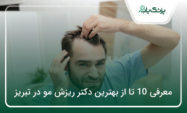 بهترین دکتر ریزش مو در تبریز