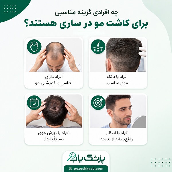 چه افرادی گزینه مناسبی برای کاشت مو در ساری هستند؟