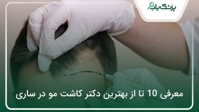 بهترین دکتر کاشت مو در ساری