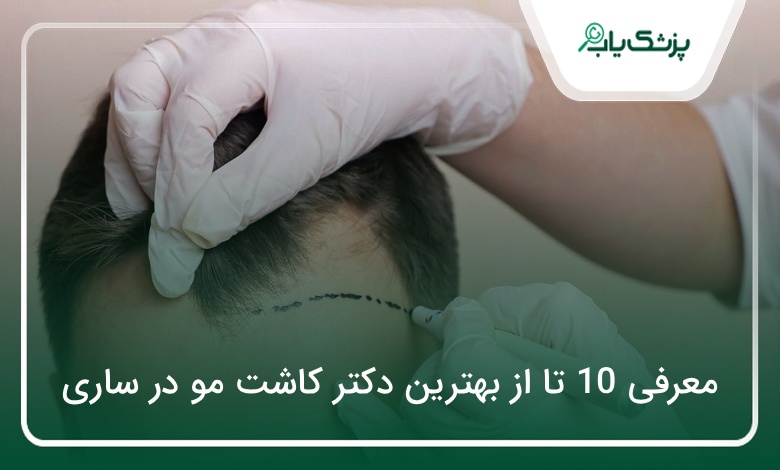 بهترین دکتر کاشت مو در ساری