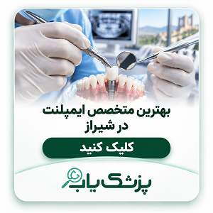 بهترین متخصص ایمپلنت در شیراز