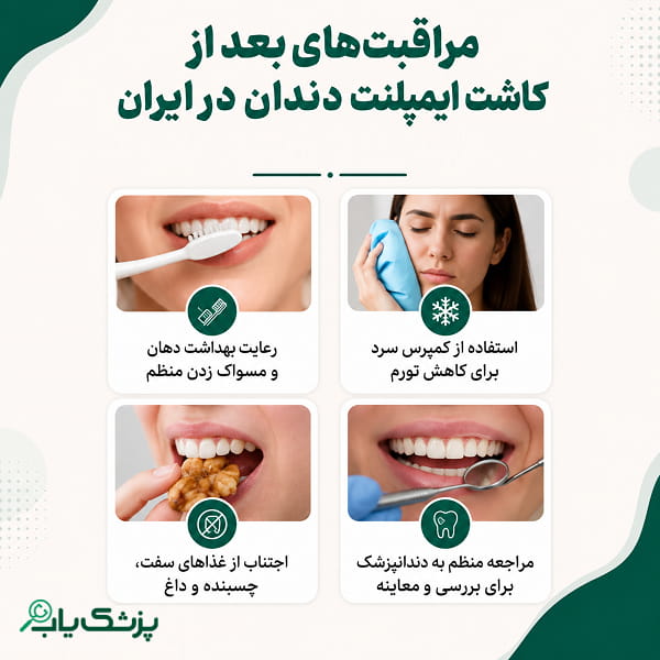 مراقبت های بعد از کاشت ایمپلنت دندان در ایران